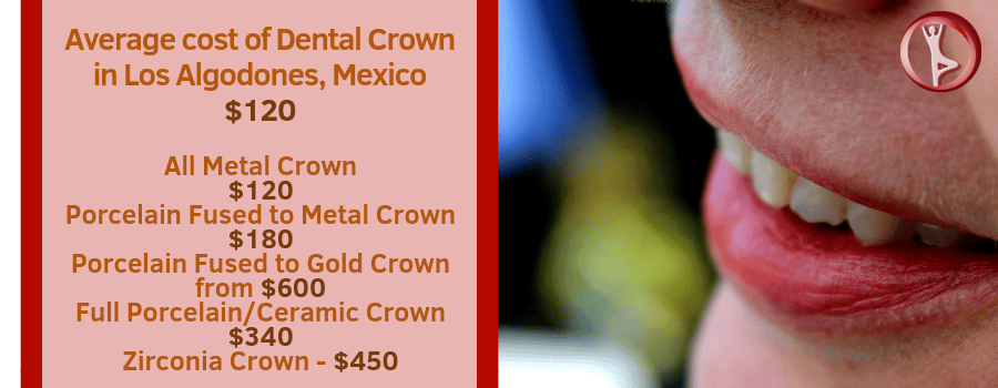 how much do dental crowns cost in Los Algodones Mexico?